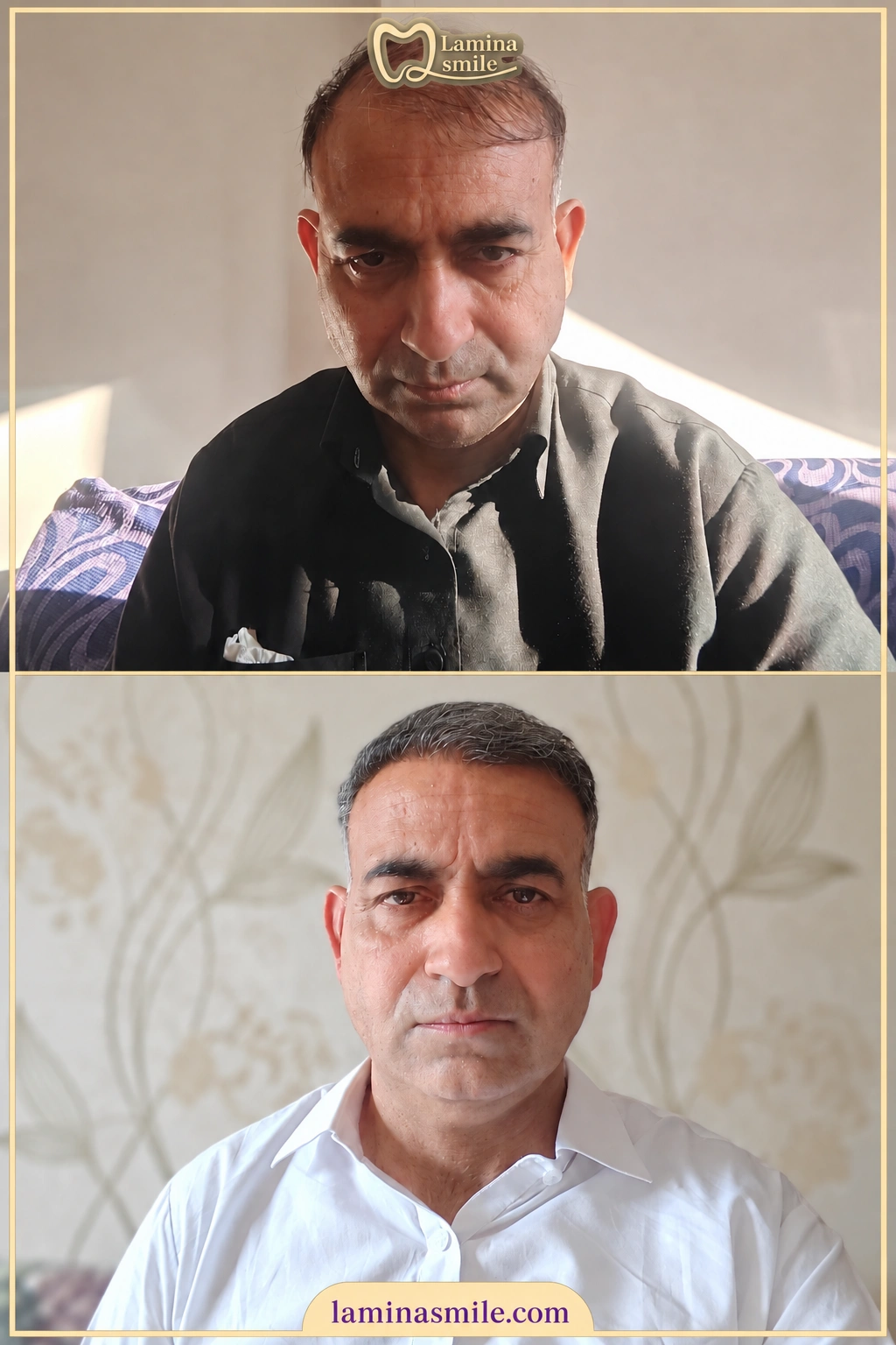 Clinic-supplied hair restoration case 7