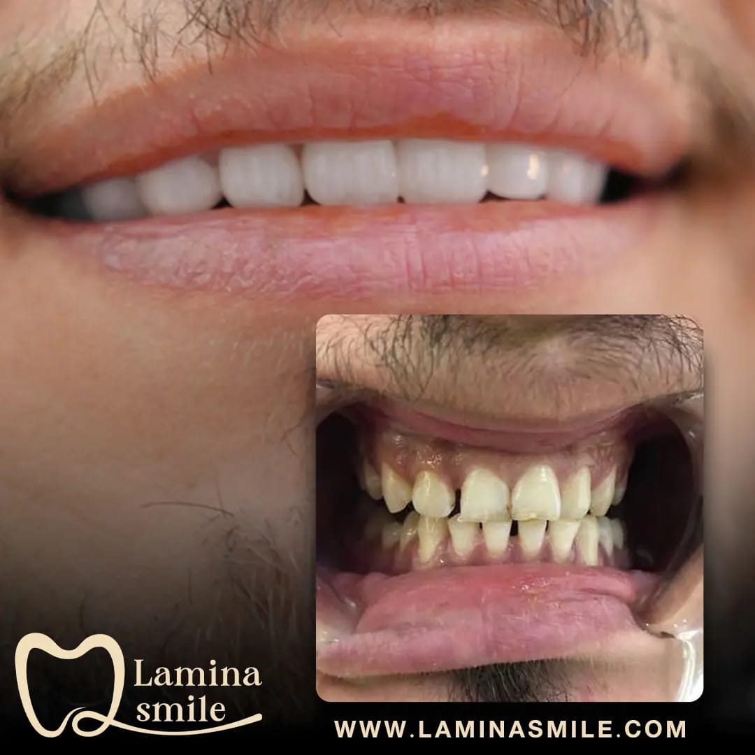 Clinic-supplied dental aesthetics case 4