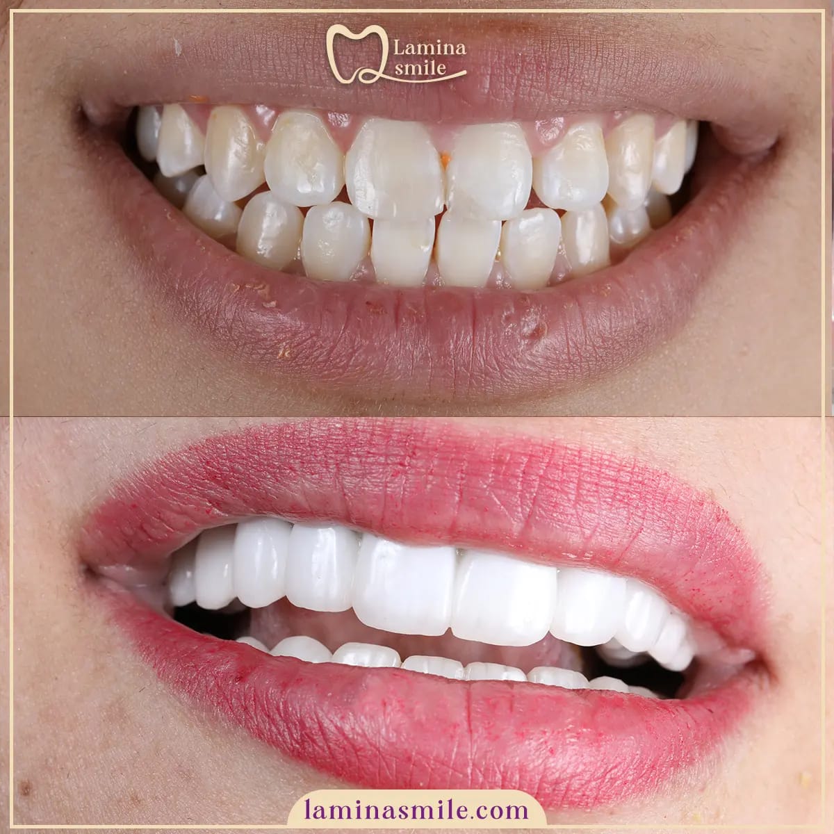 Clinic-supplied dental aesthetics case 1