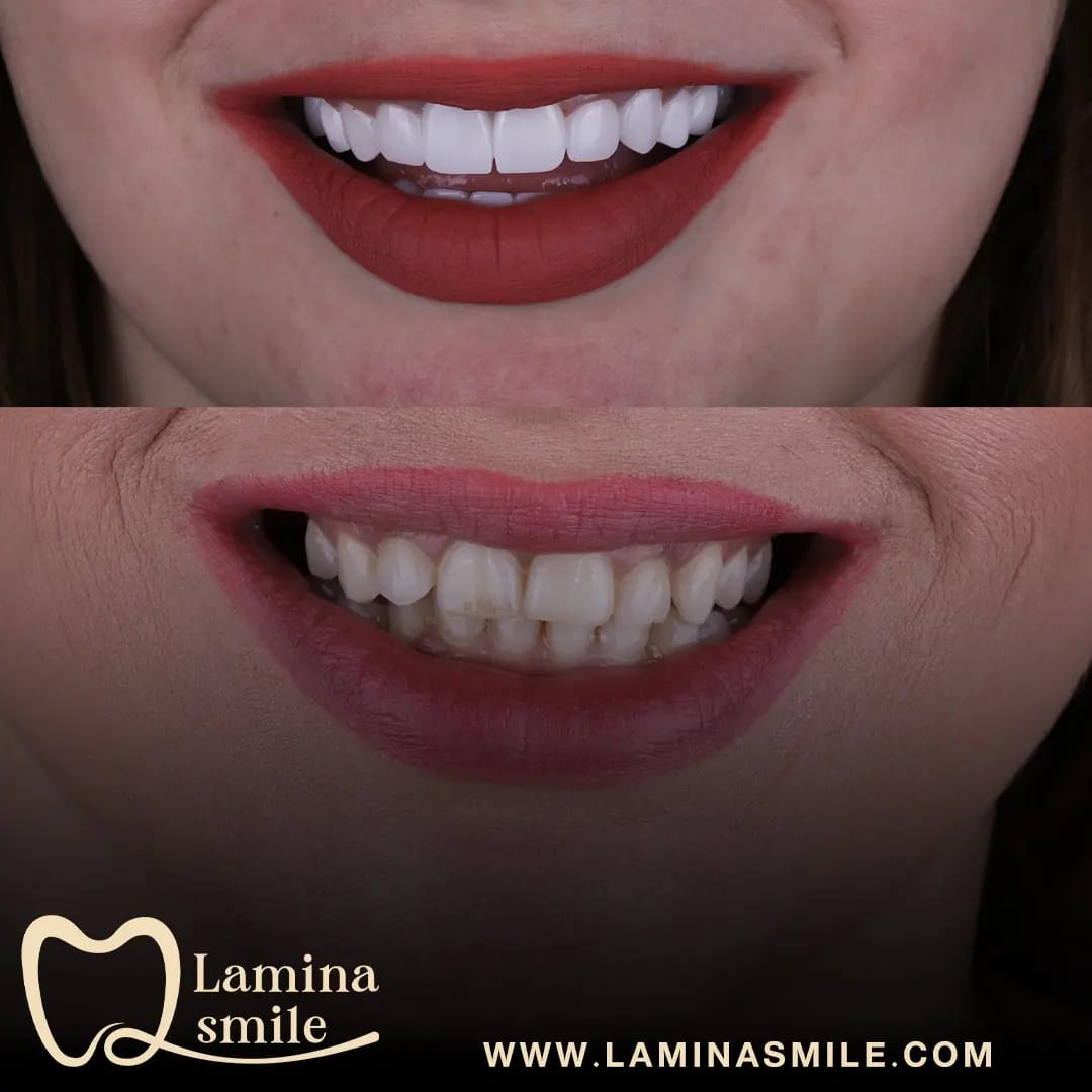 Clinic-supplied dental aesthetics case 2