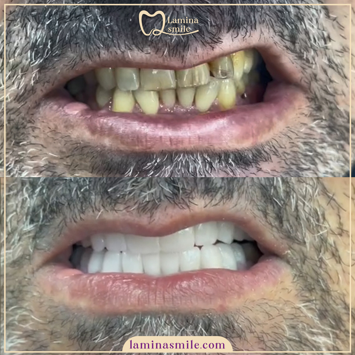 Clinic-supplied dental aesthetics case 3