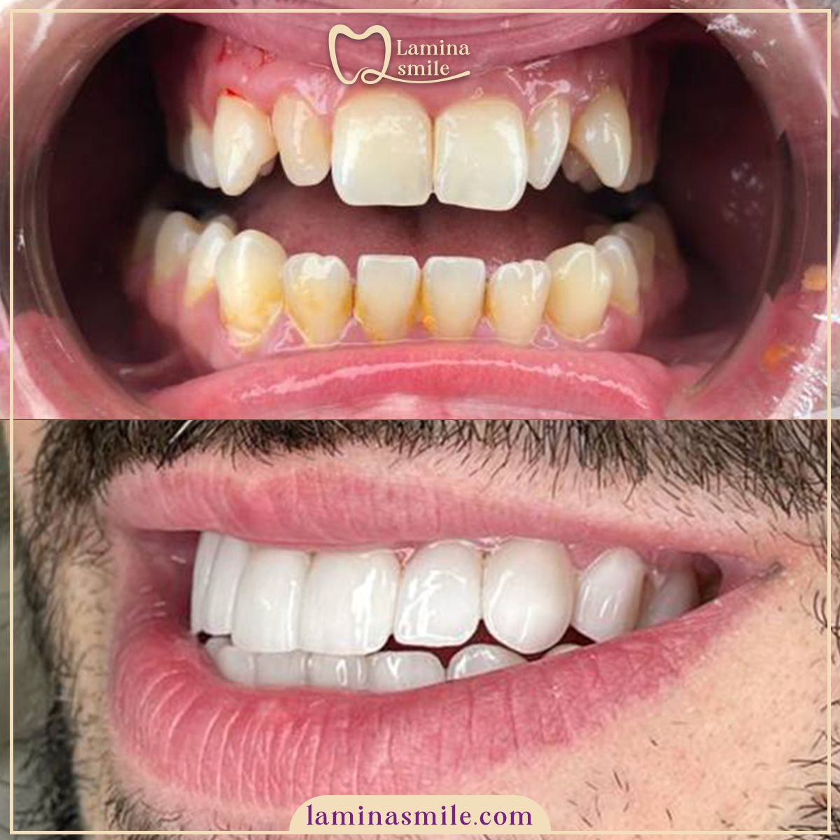 Clinic-supplied dental aesthetics case 5
