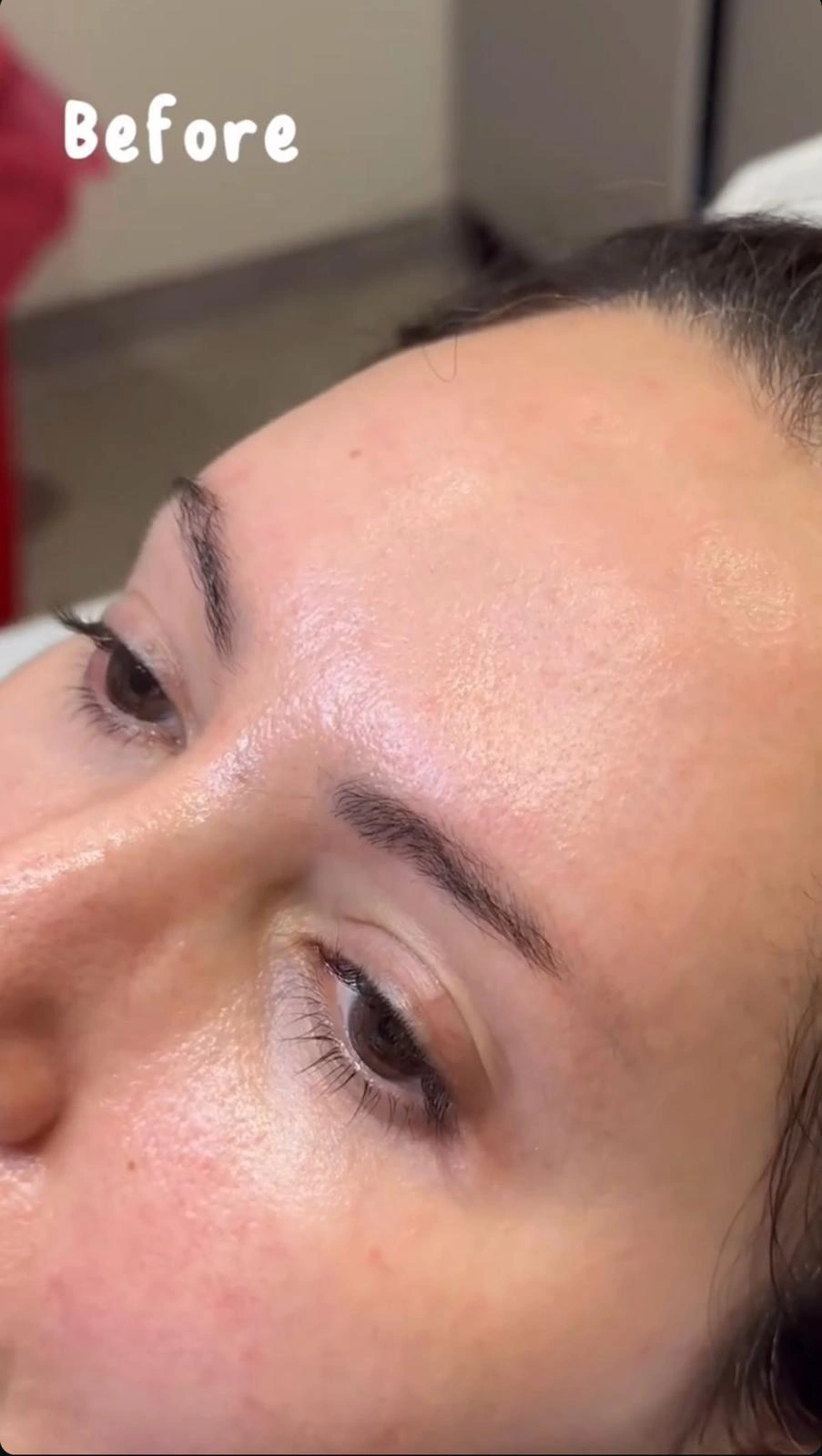 Clinic-supplied aesthetic care reference image