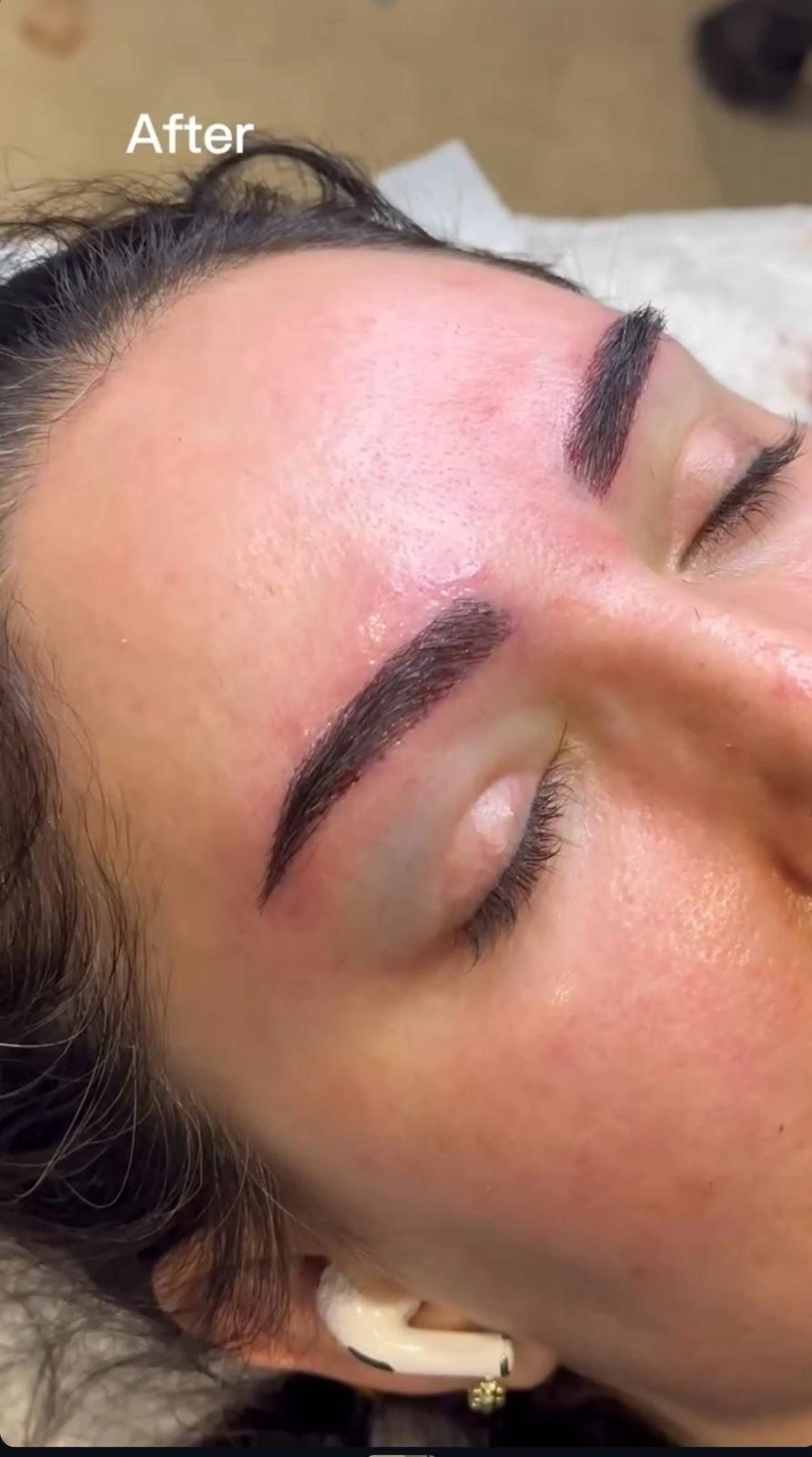 Clinic-supplied aesthetic reference image