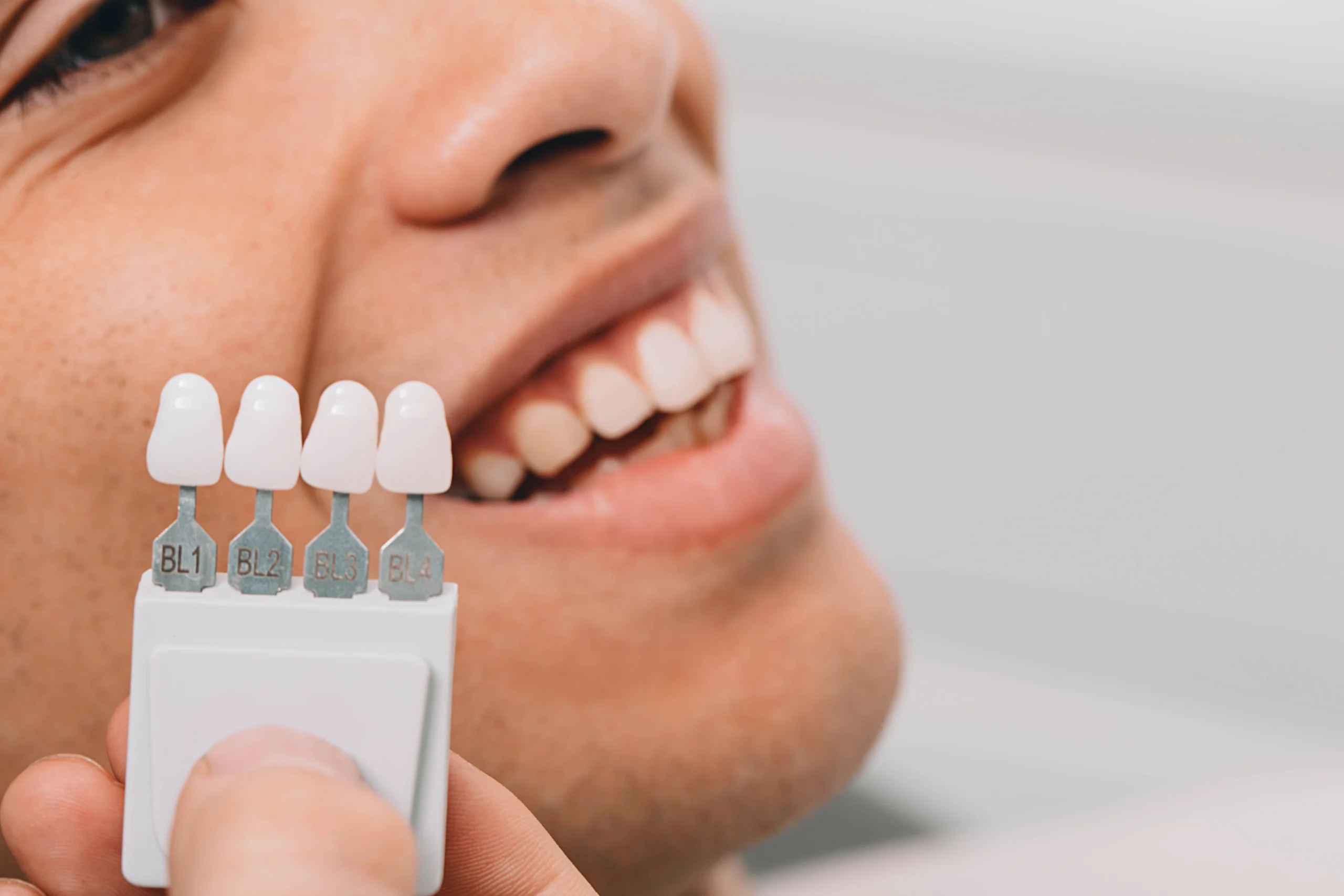 Dental treatment shade and color matching